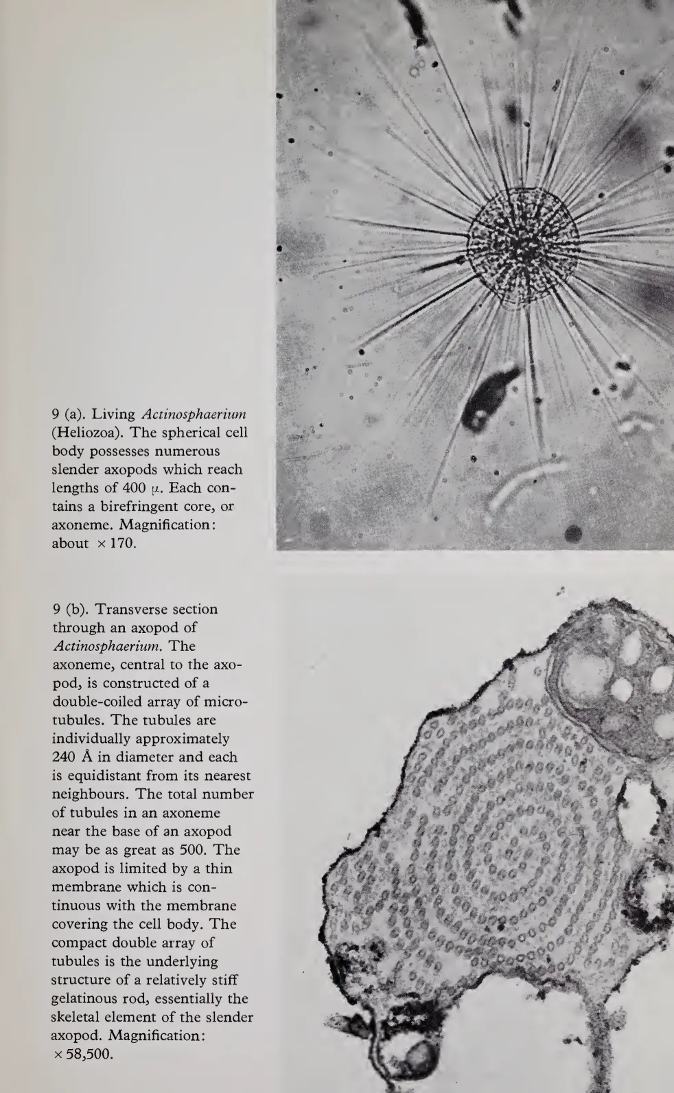 Actinosphaerium micrograph and transverse axopod section